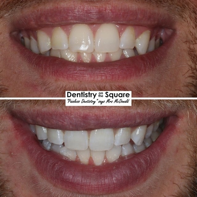 Dentistry On The Square Smile Gallery