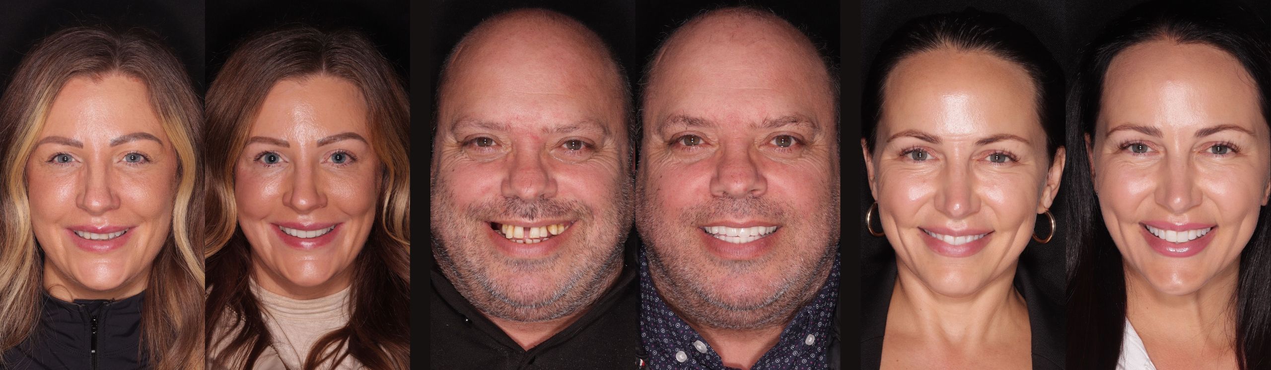 Dentistry On The Square, Pain Free Dentist Glasgow - Smile Makeovers in Glasgow Dentistry On The Square Smile Makeover Treatment