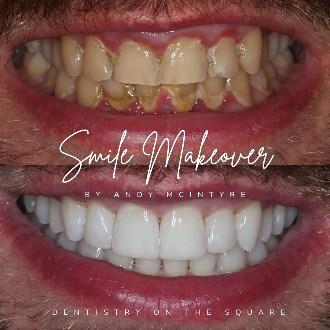 Dentistry On The Square, Pain Free Dentist Glasgow - Smile Makeovers in Glasgow Dentistry On The Square, Pain Free Dentist Glasgow - Smile Makeovers in Glasgow
